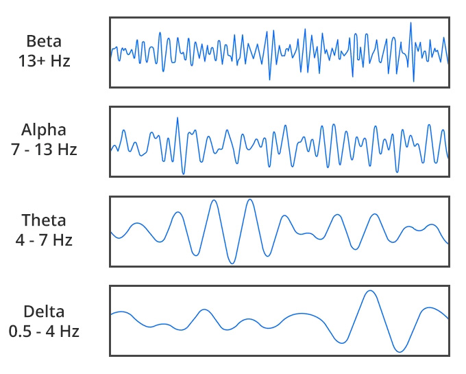 Electro Acuscope Myopulse Microcurrent Therapy Treatment System Jan Dacri eeg brain waves modified white bg 680x545