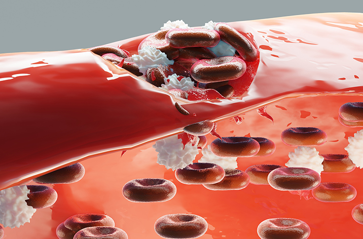 Hemostasis. Red blood cells and platelets in the blood vessel. Basic steps of wound healing process. 3d illustration