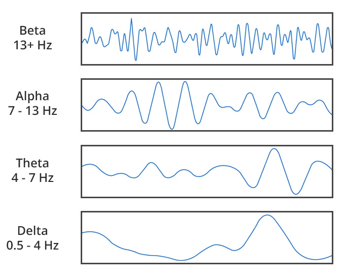 eeg brain waves modified white bg CORRECTED copy