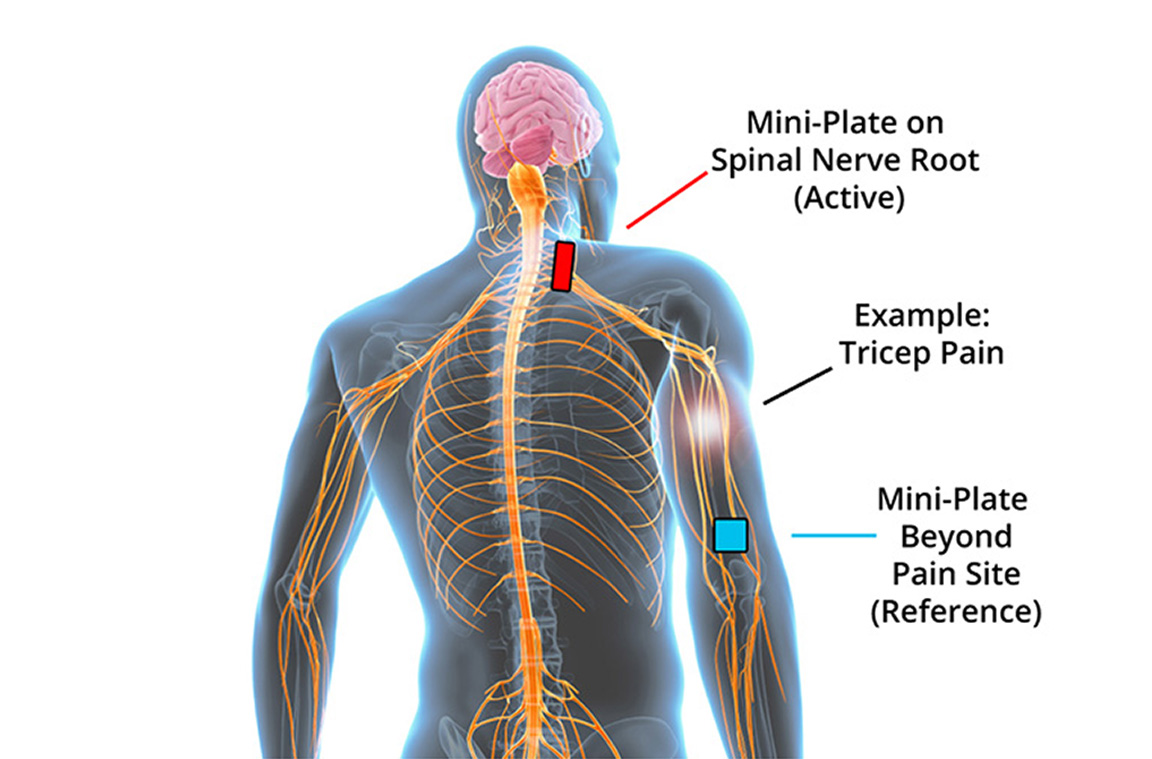 importance of proper electrode placement blog 5 3 copy